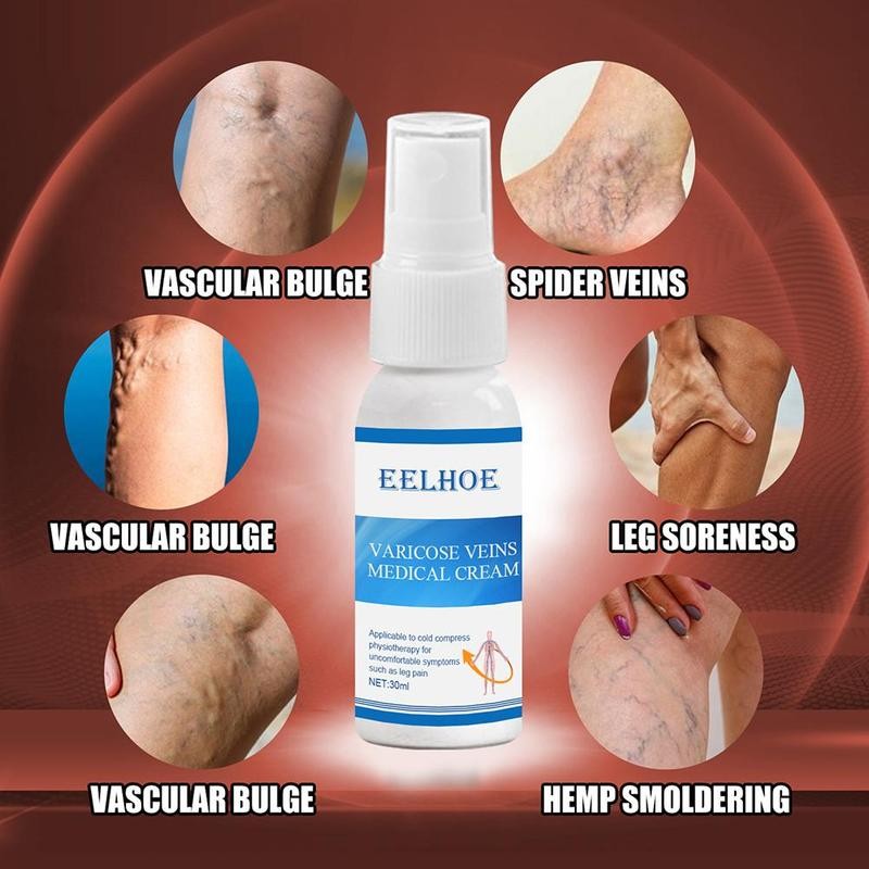 Varicose Veins Spray Cream