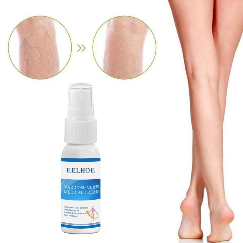 Varicose Veins Spray Cream