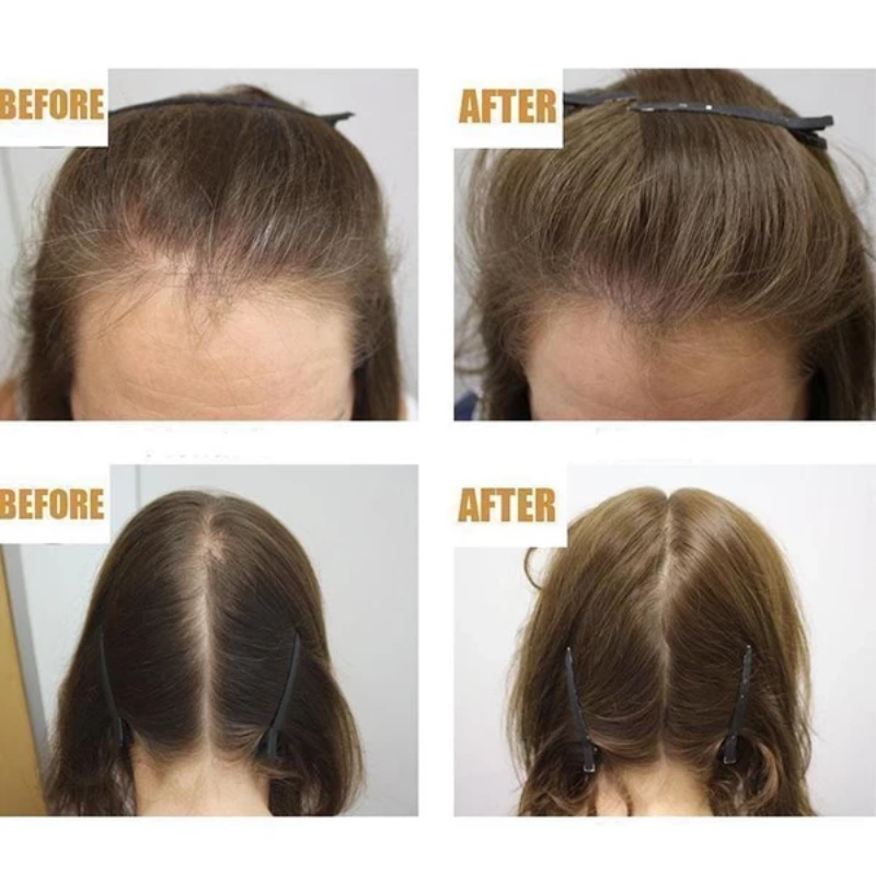 Vixily Natural Hair Serum - Vixily
