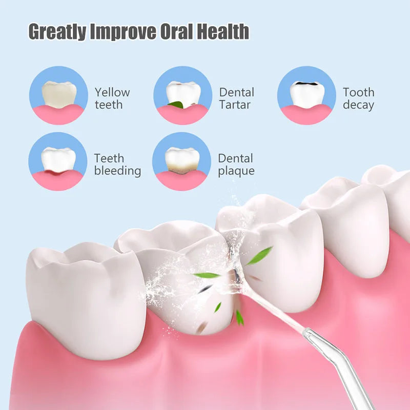 Jet Dental Flosser Irrigator